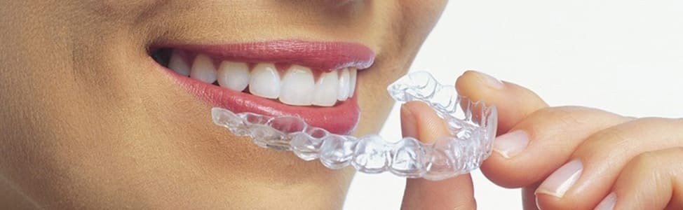 Invisalign Clear Aligners | Jubilee Dental Centre | Summerland, BC